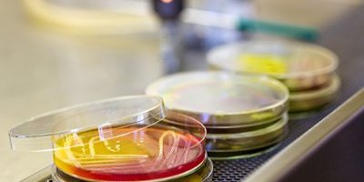 Les antioxydants : lésions cellulaires et vieillissement
