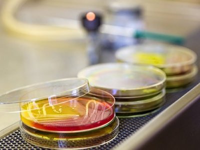 Les antioxydants : lésions cellulaires et vieillissement