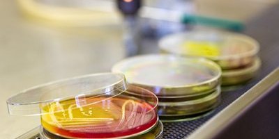 Les antioxydants : lésions cellulaires et vieillissement